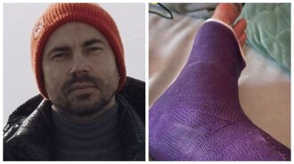 Андрій Бєдняков зламав ногу під час тренування: "Спорт – зло"