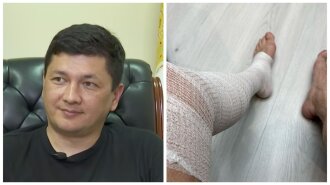 Краш українок Віталій Кім отримав серйозну травму: "Ходити забороняють" (ФОТО)