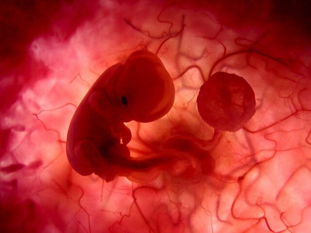 feto-com-1-mes-na-barriga