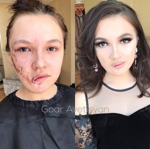 Гоар Аветисян меняет внешность женщины с «трагедией на лице»