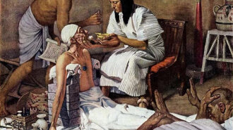 Вчені розповіли, якою була медицина в стародавньому Єгипті