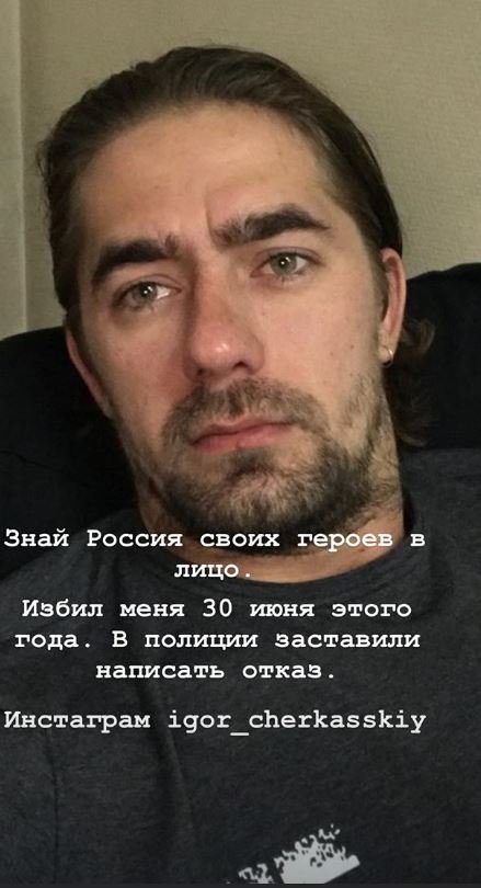 Kira Dice обвинила продюсера Игоря Черкасского в избиении