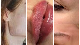 Вивернуті губи, обличчя-праски: які дивні косметологічні послуги стали популярними останнім часом
