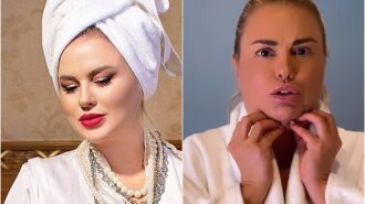 Втомилася від дієт: 43-річна Семенович відкачала жир на підборідді-записала все на відео