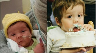 недоношені діти, фото, до і після