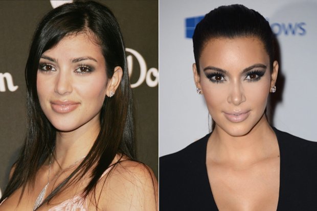 Ким Кардашьян, до и после