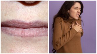 Посинение губ, одышка и не только: врач назвал неочевидные признаки серьезных проблем с сердцем и сосудами
