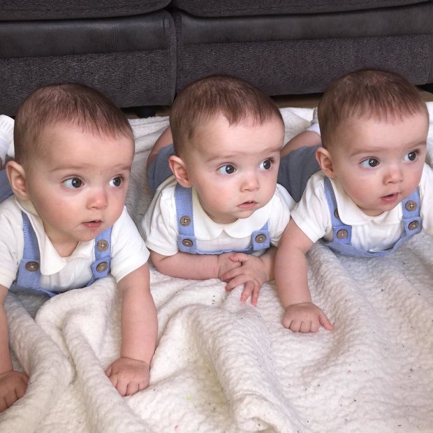 Первый в мире случай рождения однояйцевых тройняшек