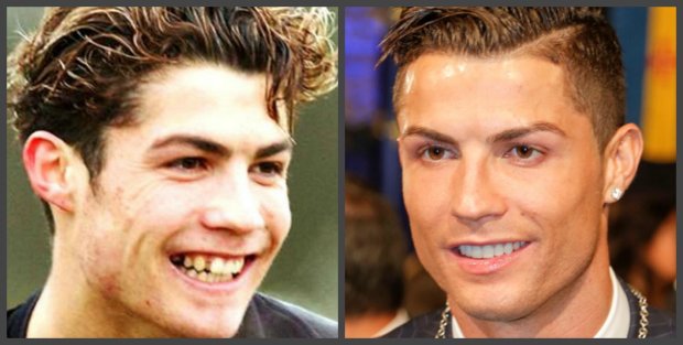 Криштиану Роналду: фото до и после
