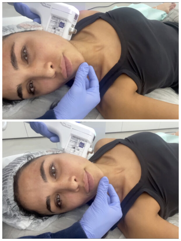 36-летняя Санта Димопулос с кушетки косметолога раскрыла секрет своей красоты