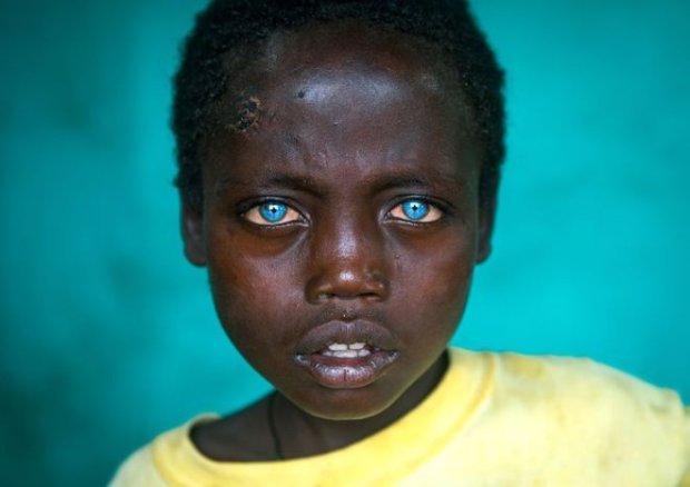 Абаш — уникальный мальчик, благодаря цвету своих глаз
