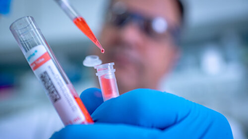Вчені розповіли, яка група крові має "захист" від коронавіруса