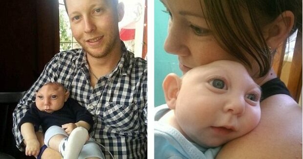 Мальчик родился без мозга и выжил, вопреки всему: как он выглядит спустя 6 лет (ФОТО)