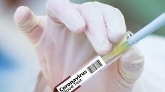 Статистика: в Україні виявлено понад 12 тисяч випадків зараження коронавірусом