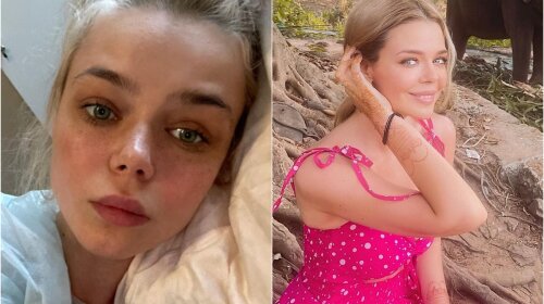 27-летняя Гросу показала первые фото после реабилитации: как изменилась внешность знаменитости за две недели