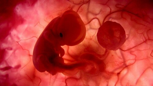 feto-com-1-mes-na-barriga