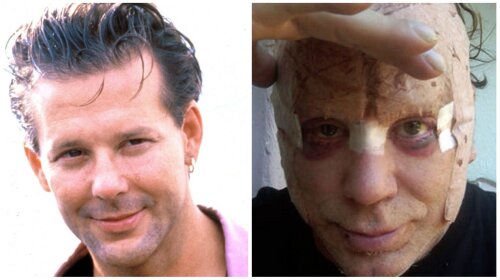 З красеня в чудовисько: чому пластичні операції Міккі Рурка зіпсували йому обличчя і кінокар'єру?