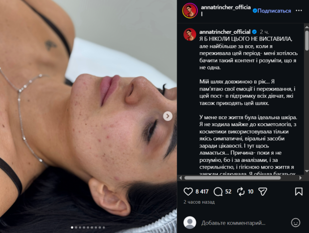 Анна Трінчер без макіяжу
