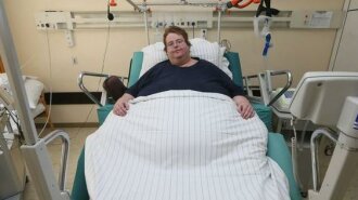 "Ви що, не побачили мої геніталії?": у США чоловікові з ожирінням помилково зробили кесарів розтин