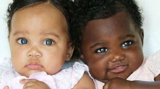Уникальные близнецы: как выглядят сестры, которые родились с разным цветом кожи (ФОТО)