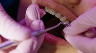 Стертые зубы: стоматолог назвал причины и способы восстановления