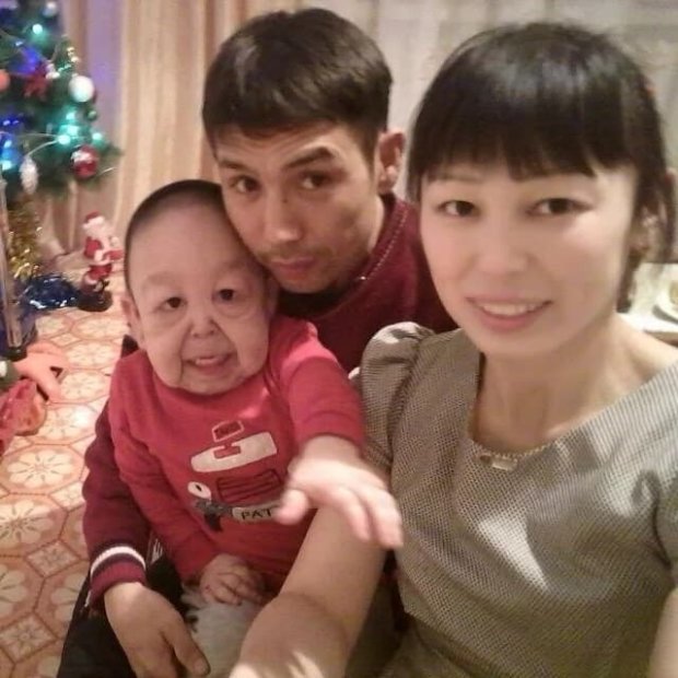Мальчик-старик Ернар Алибеков со своими родителями