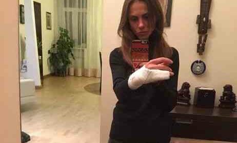 В Киеве патрульные полицейские сломали девушке руку (фото, видео)