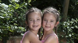 Сіамські близнюки народилися з одною черевною порожниною на двох: якими вони стали через 7 років (ФОТО)
