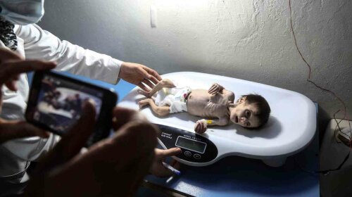 Как кукла из фильма ужасов: этот ребенок — символ жертв войны в Сирии