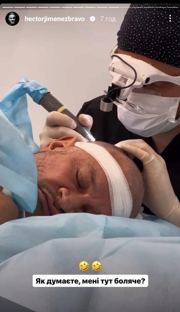 Ектору Хіменесу-Браво провели операцію, через яку він поголився налисо