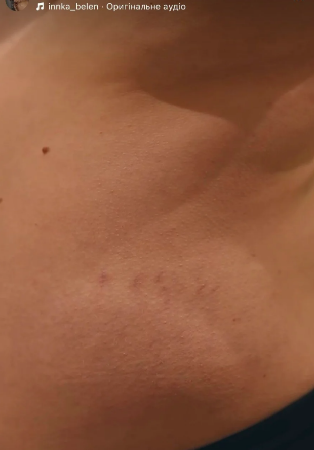 Скрин публикации Инны Белень