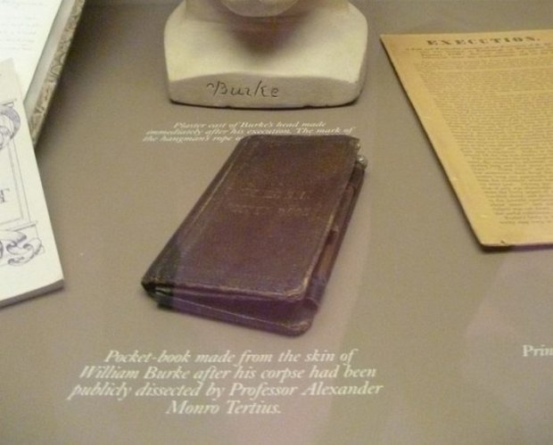Книга из человеческой кожи (Хирургический музей патологий, Эдинбург, Шотландия)