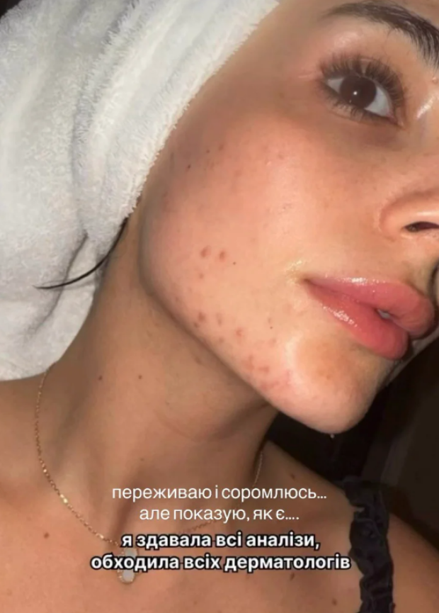 Анна Трінчер без макіяжу