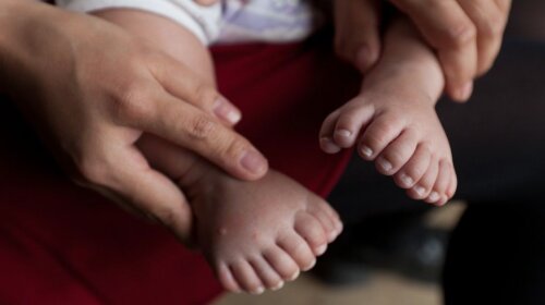 В Китае родился младенец с 31 пальцем