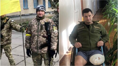 История добровольца ВСУ, потерявшего ногу в российской военной агрессии: фото