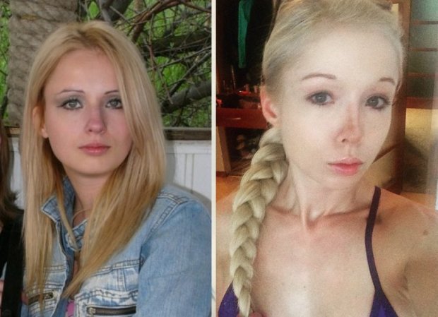 Валерия Лукьянова: до и после