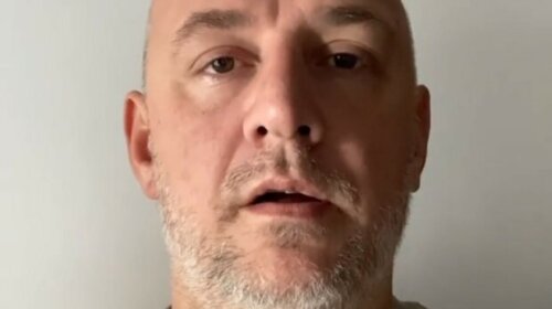 "Прямо як Джастін Бібер": Потап налякав фанів хворобливим виглядом — що відбувається