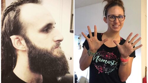 Не недостаток, а изюминка: ТОП-10 людей, которых природа наградила уникальной внешностью (ФОТО)