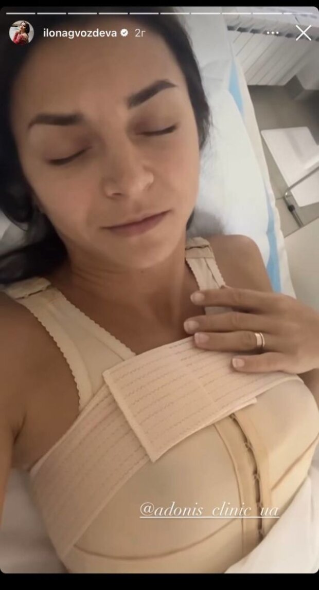 Ілона Гвоздєва збільшила груди та показала перше фото з лікарні
