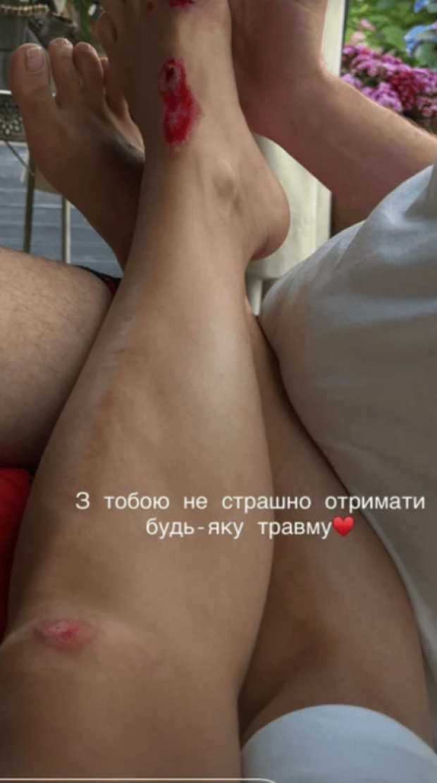 Анна Неплях та Олександр Гудков