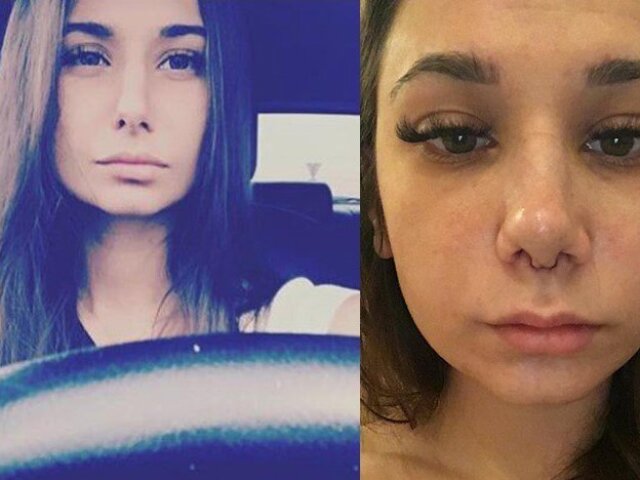 Олександра до і після операції