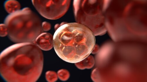 "Раковые клетки есть у всех": гинеколог назвала главные факторы развития онкозаболеваний