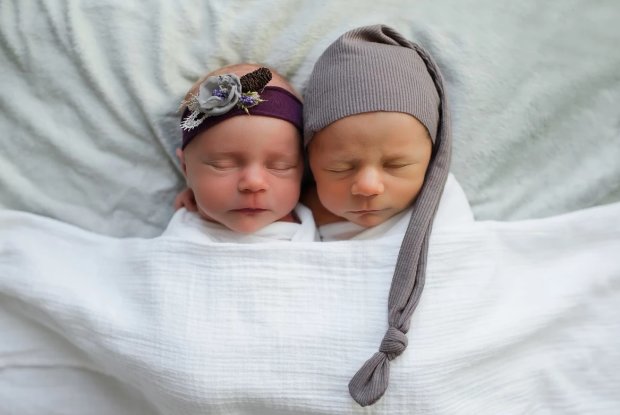 Батьки влаштували фотосесію для близнюків, поки один з них ще живий