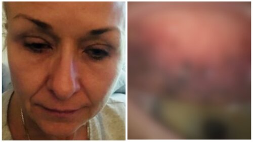 Лікарі ахнули: що стало з жінкою, яка не змивала туш з очей 25 років (ФОТО)