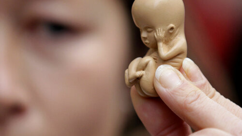 Які реальні наслідки аборту? Гранично чесна відповідь спеціаліста