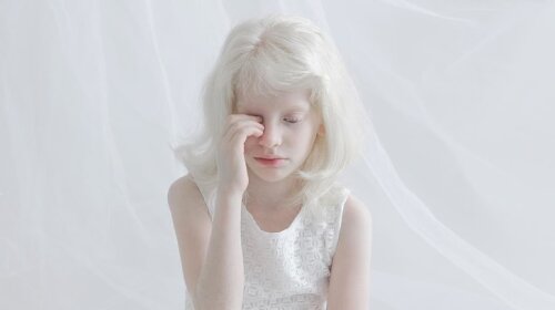 Уникальная красота альбиносов, которая покорила мир моды