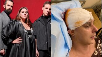 Проломили череп і пошкодили око: на автора пісень групи KAZKA напали в в під'їзді власного будинку-подробиці події