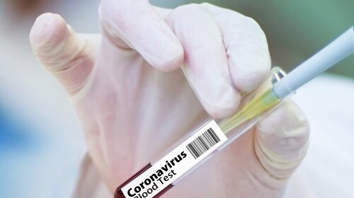 За сутки в Украине выявлено более 400 новых случаев заражения коронавирусом