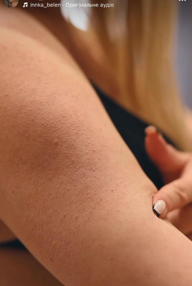 Скрин публикации Инны Белень