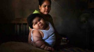 MEXICO-HEALTH-CHILD-OBESITY